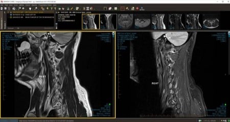 And just like that, the next person taking your x-ray might be able to order a 3D printed model to find out how to proceed.